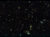 This image, taken by NASA’s James Webb Space Telescope in August 2022, features a small part of the sky (only the size of about one tenth of the diameter of the moon) around the brightest quasar that is known to date in the very distant universe. This quasar