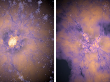 Early dark energy could have triggered the formation of numerous bright galaxies, very early in the universe, a new study finds. The mysterious unknown force could have caused early seeds of galaxies (depicted at left) to sprout many more bright galaxies (at right) than theory predicts.